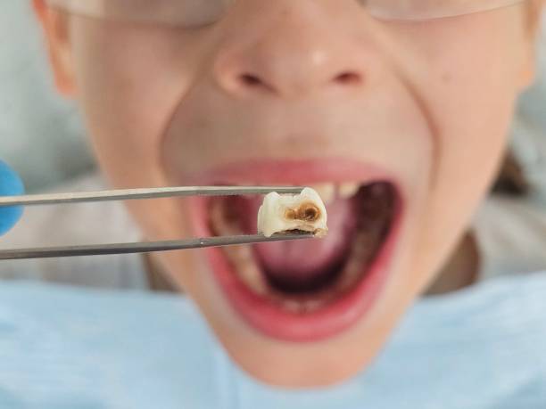 Best Emergency Dental Services for Seniors in Clayton, OH